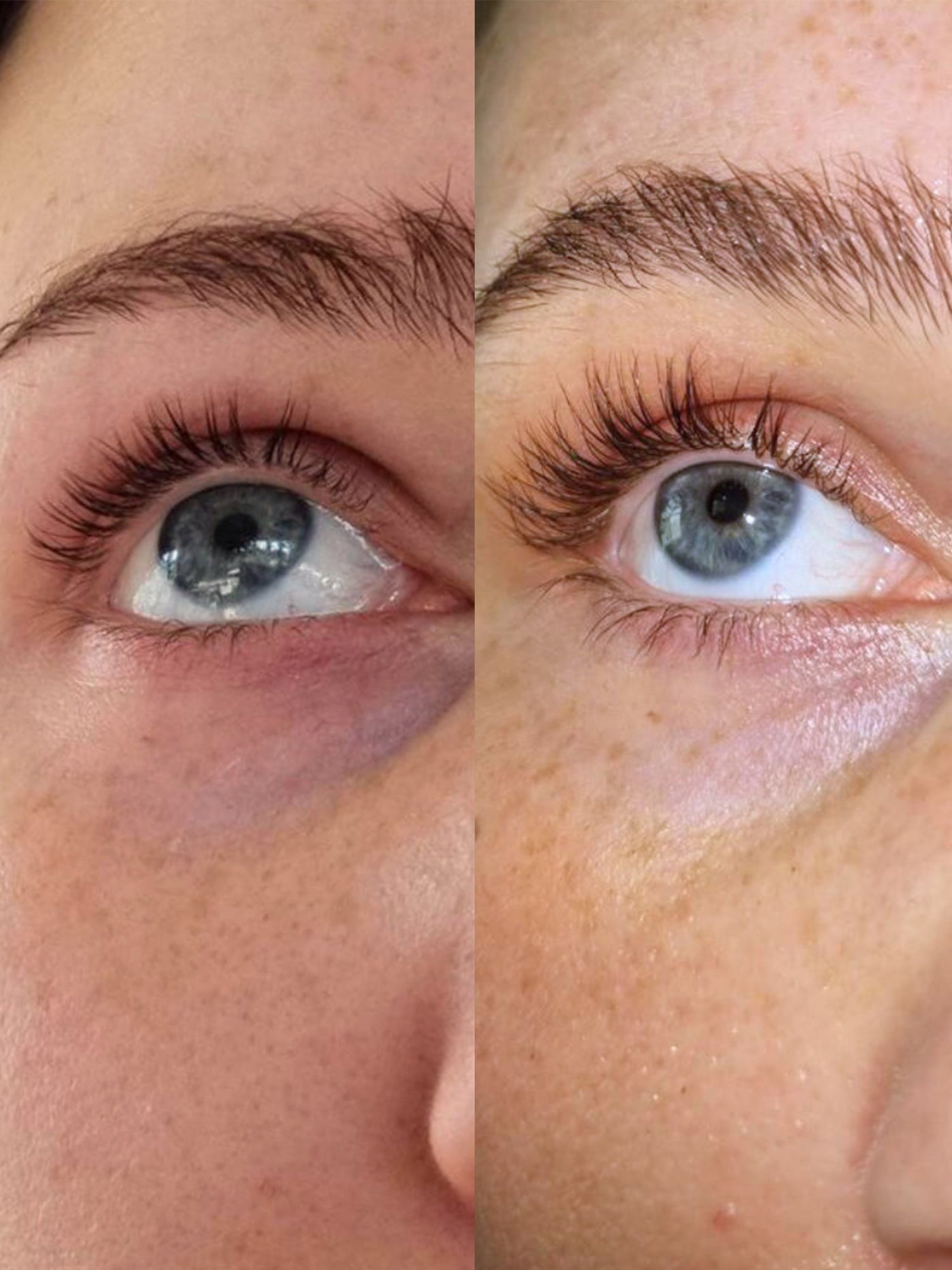 Eyelash Growth Serum